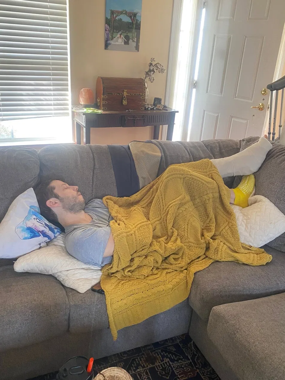 Joshua napping on the couch with his leg elevated in a cast